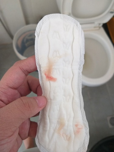 MUCUS PLUG PO BA ITO?