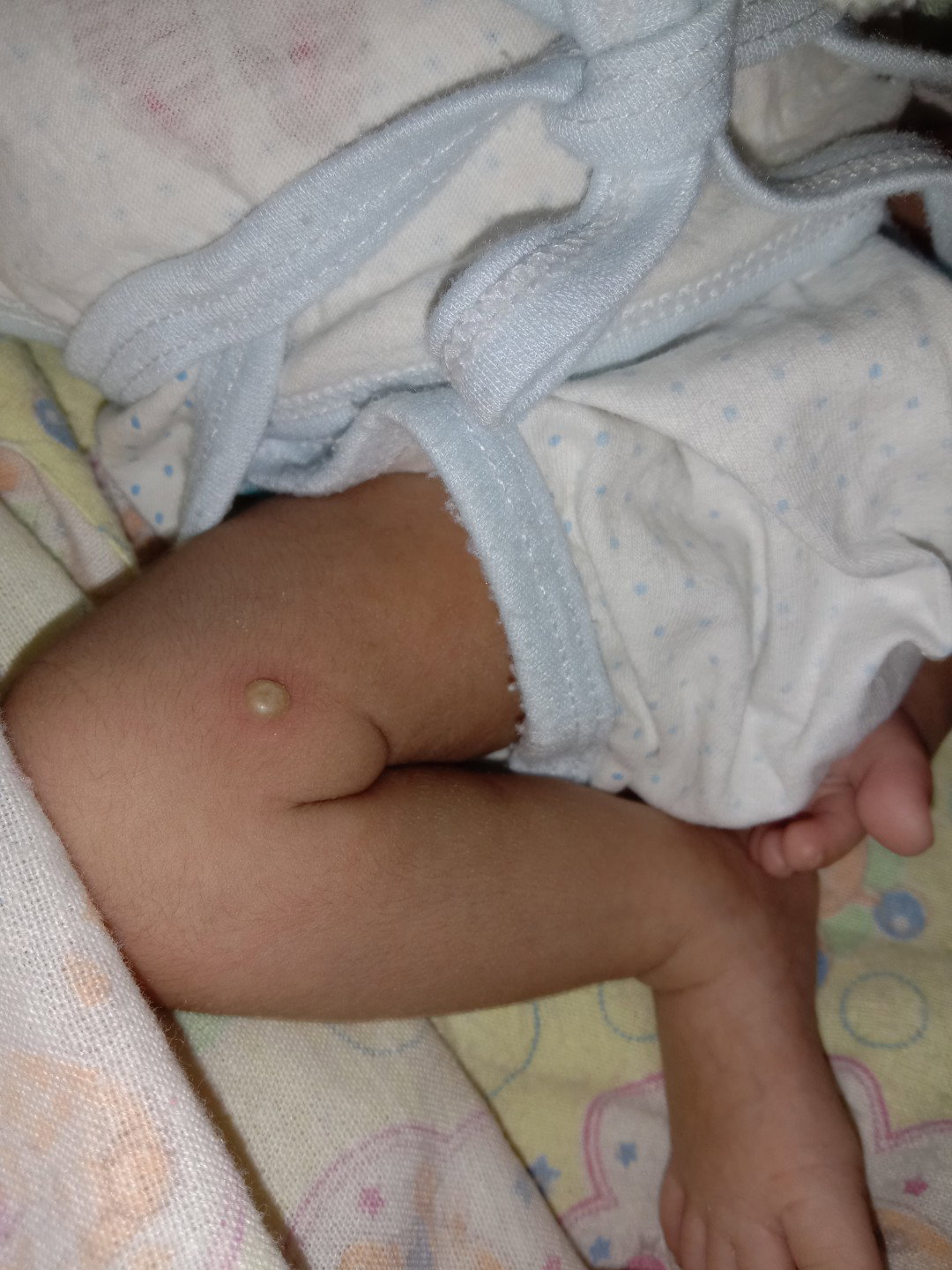 bayi 19 hari