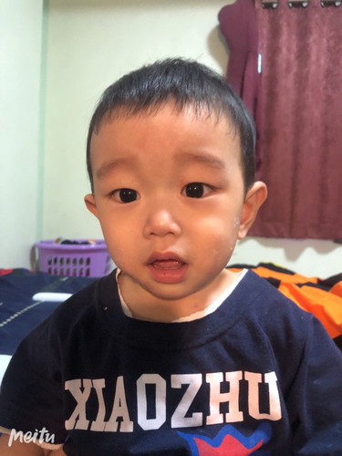 ลูกอายุ10 เดือน อยู่ๆเมื่อคืนก็ตัวร้อน