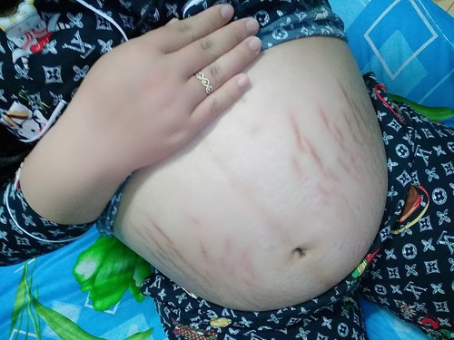 Ken Yêu Của Mẹ ?