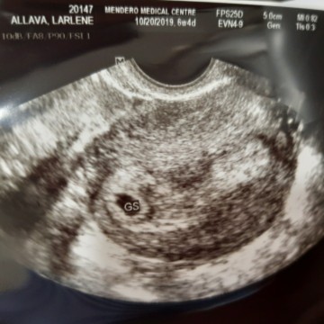 First Ultrasound