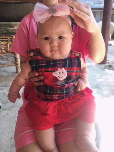 น้องอายุ3เดือน27วันน้ำหนัก8.6กิโลค่ะช่วงเดือนแรกเสริมนมผงค่ะ