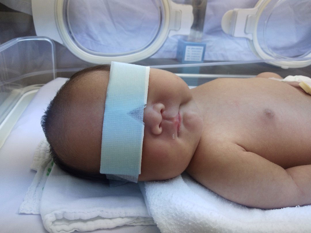 ประสบการณ์ลูกตัวเหลือง