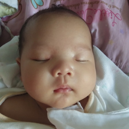 สำลักน้ำคร่ำ