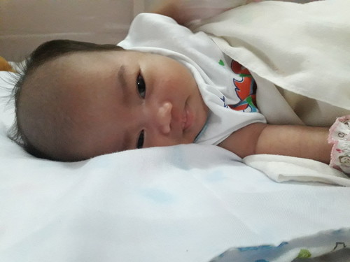 ลูกผมบางทำไงดี