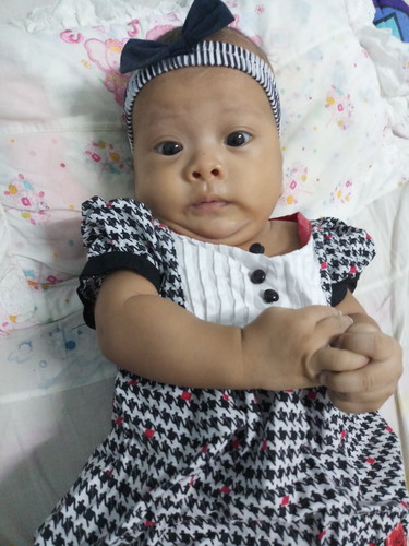 ลูก3เดือนชอบแหงนหน้า