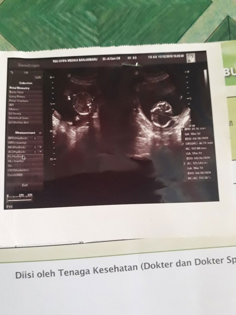 Benar2 merasa bersyukur atas semua ny??