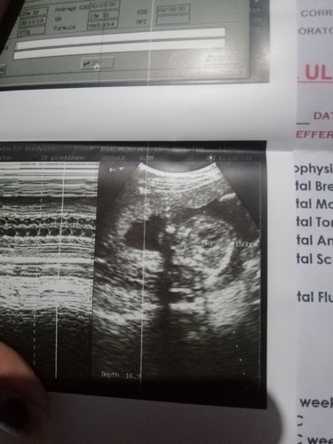 5 months ultrasound.