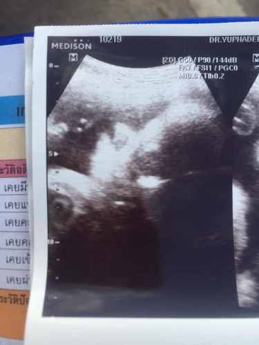34 week