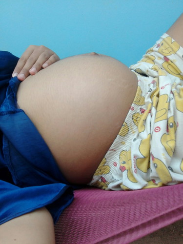 ท้องแบบนี้ จะดูยังไงถึงรู้ว่าได้ลุกผู้หญิงรึผู้ชายอ่ะ