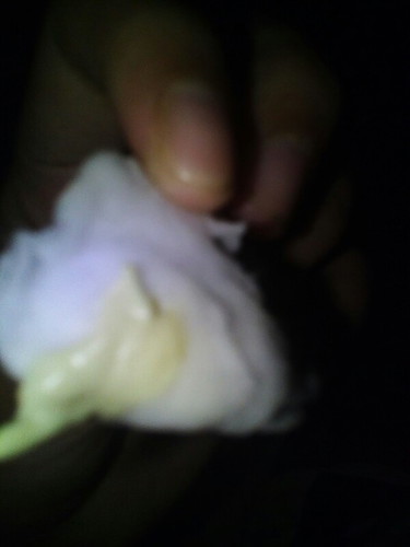 Yellowish Milky Disharge