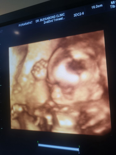 สวัสดีค่ะ แม่ๆชวยตั้งชื่อเล่นน้องหน่อยค่ะ