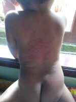 ini knp yaa ??? herpes kah?