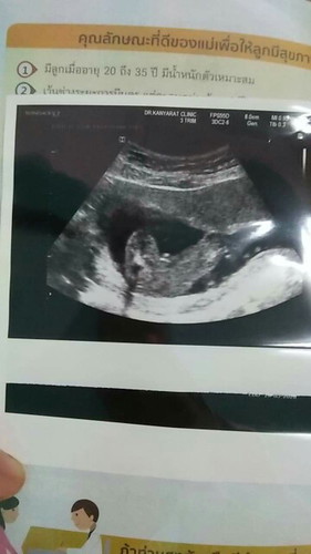 ช หรือ ญ