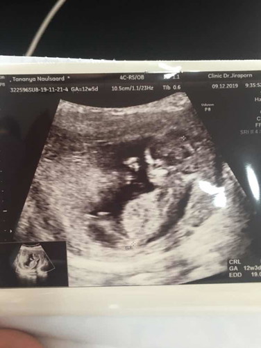 12 week 3 day.