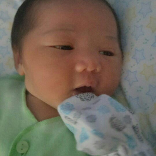 tanda merah darah di mata