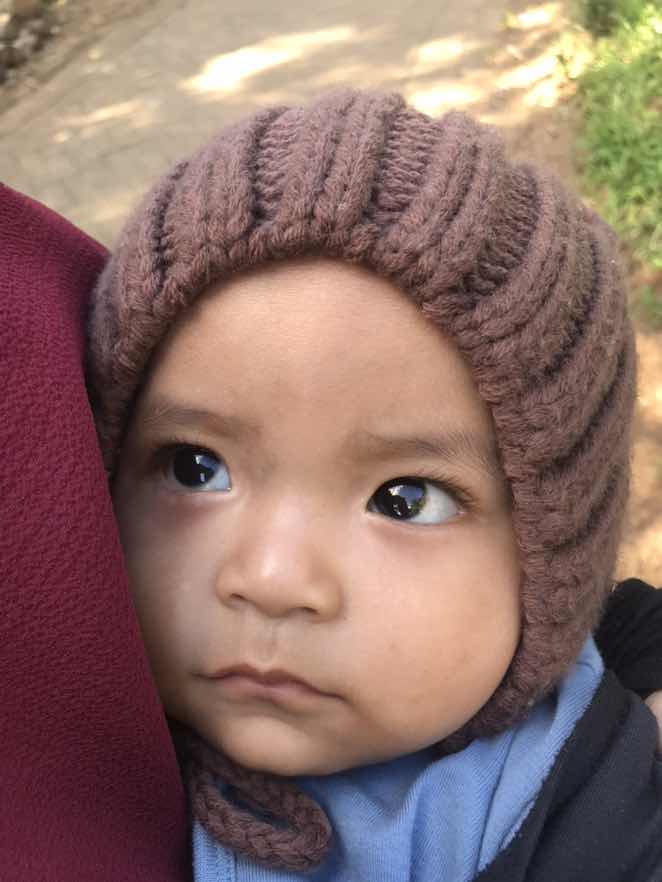 TIDAK BISA MENCIUM BAU DAN MERASAKAN