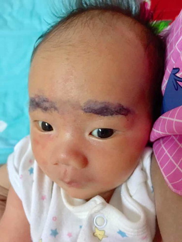 อยากคิ้วหนา