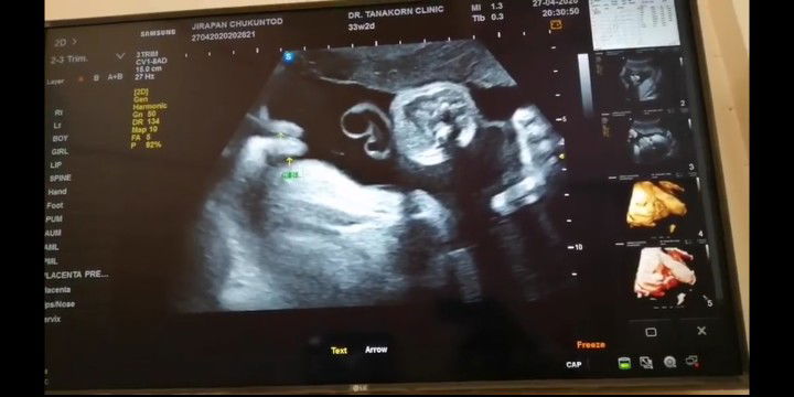 ฝันว่าได้อุ้มเด็กผู้ชาย​