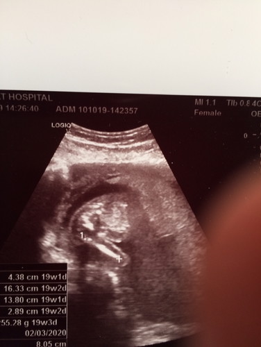 ผลอัลตราซาวด์