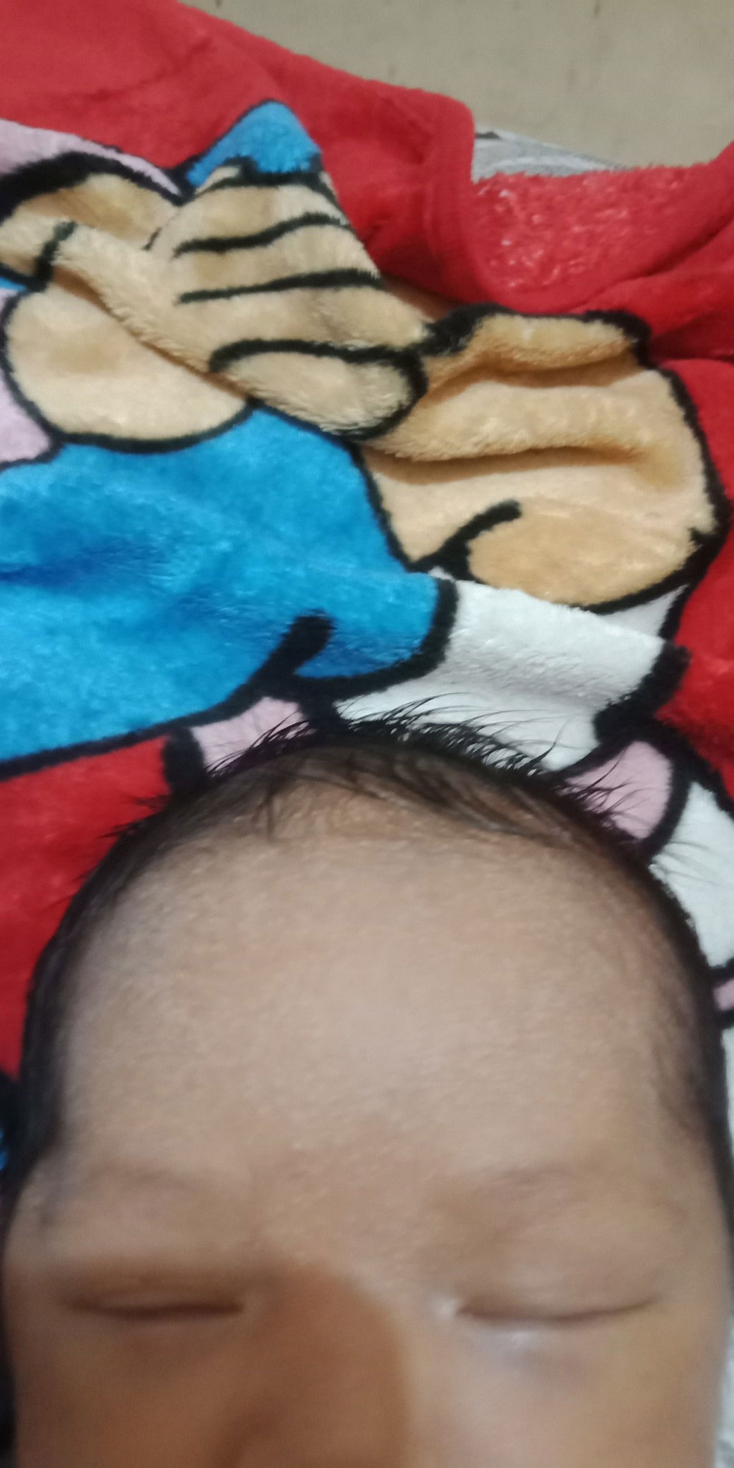 mata bayi agak memar