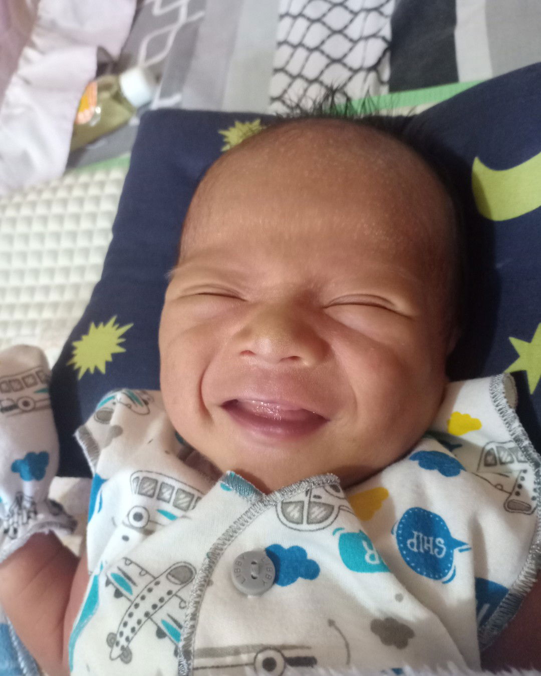 kepala panjang karena lahiran normal