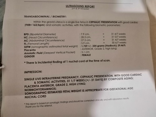 Delekado Po Ba Ang Nuchal Cord