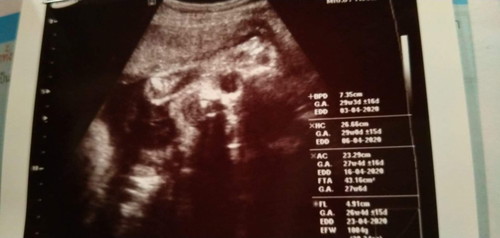 28w