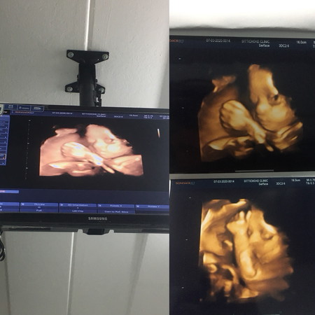 ดิ้นเก่งมาก?