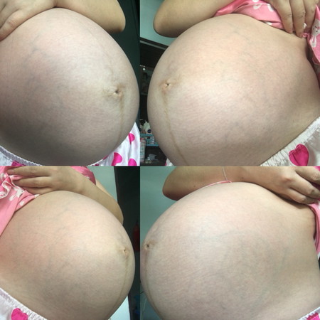 อวดท้องกันหน่อย แม่35w แล้ว ลุ้นว่าจะรอดมั้ย