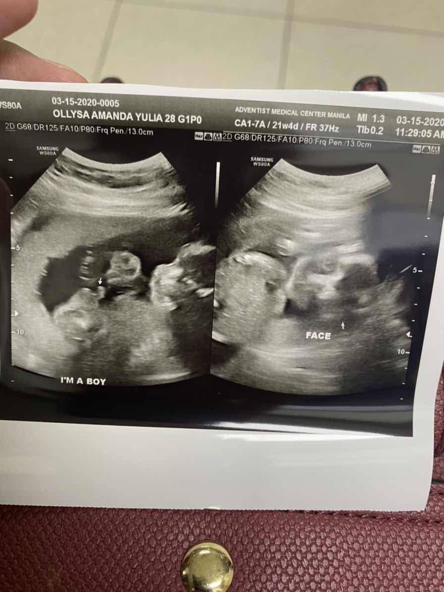 Mitos prediksi jenis kelamin