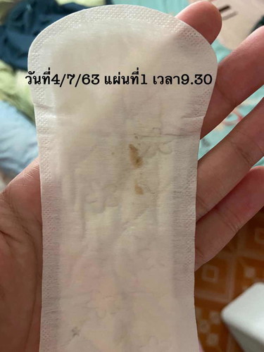 ท้องได้34wกับอีก5วัน มีเหมือนคราบเลือดหยดออกมา