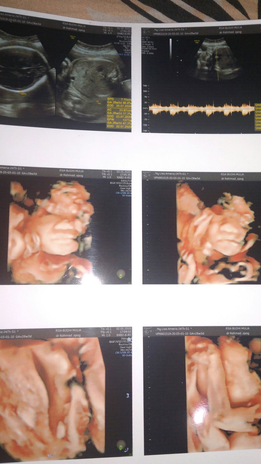 songsang bisa normal gk?