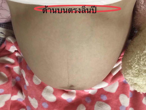 ขอสอบถามหน่อยคะ ถ่ายจากข้างบนลงล่างตะ