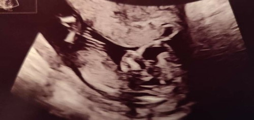 เเม่ๆคิดว่าชายหรือหญิงค่ะ?