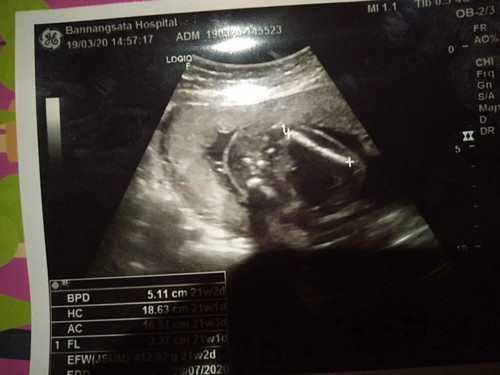 4 สัปดาห์