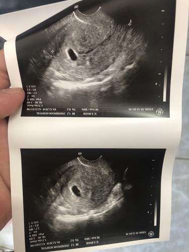 ตั้งครรภ์