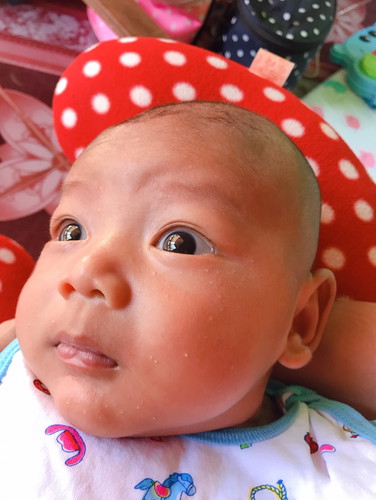 ตุ่มขาว