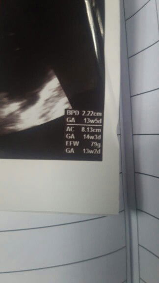 usia kehamilan saya berapa minggu?