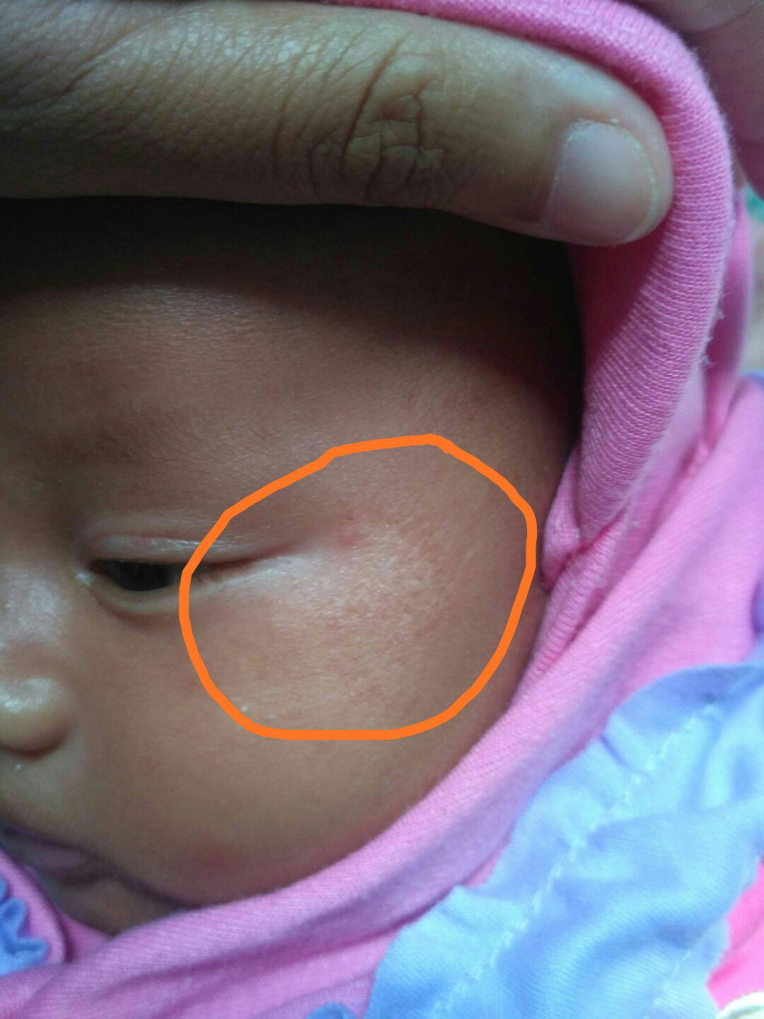 Disekitar Mata Kulit Memutih