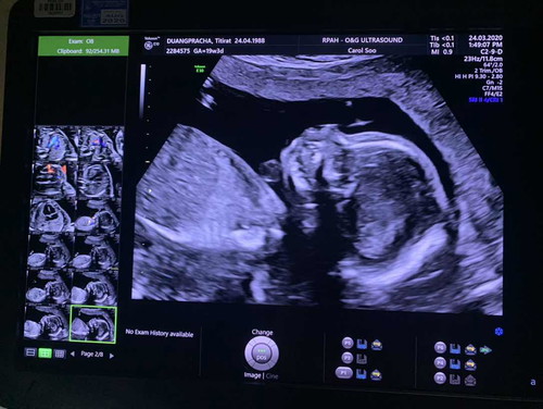 แชร์ประสบการณ์ไปหาคุณหมอช่วงโควิทกันค่ะ ?