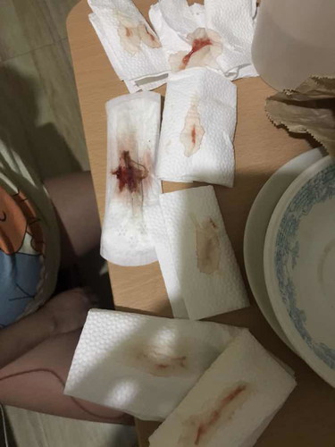 BLOODY DISCHARGE 40 weeks and 3 days