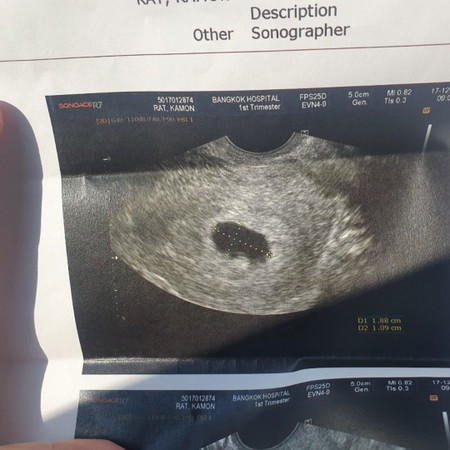 ไปซาวมายังไม่เจอตัวน้องง