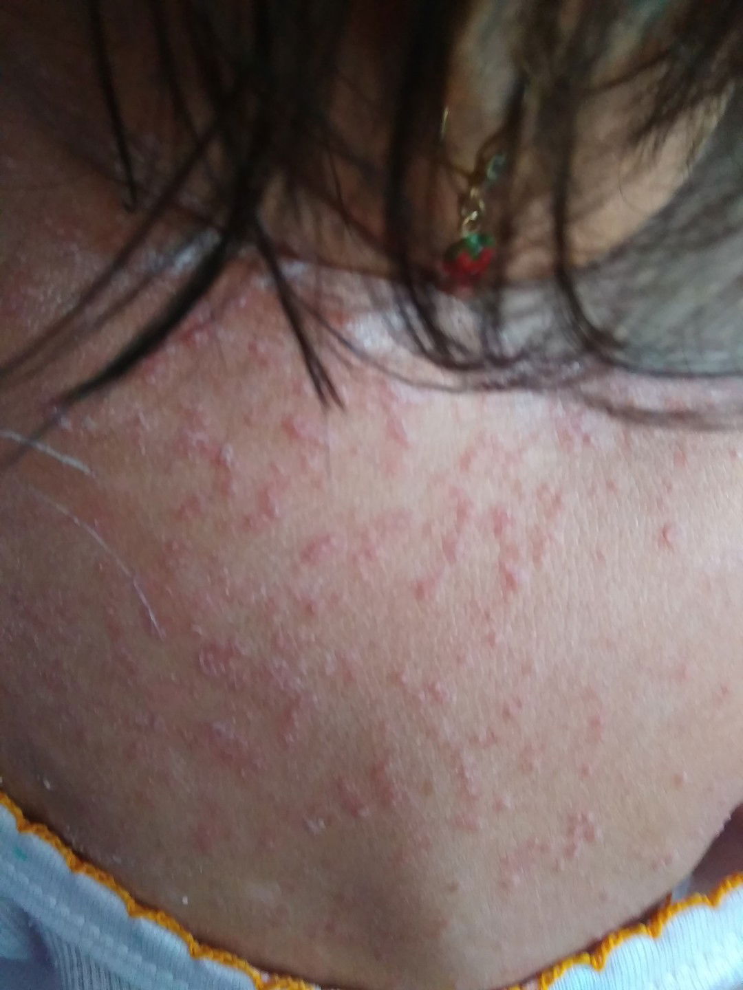 gmn solusinya tntg gtal2 buat bayi