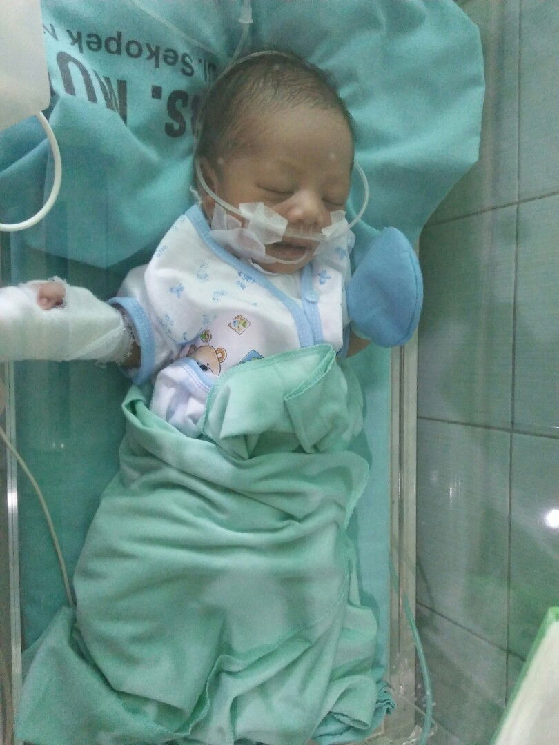 My baby jantungnya bocor ?