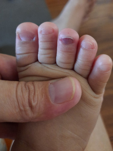 จะเป็นอะไรไหมค่ะ