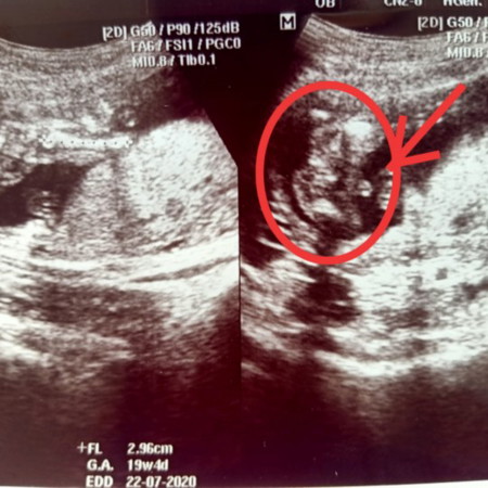 รบกวนแม่ๆ ช่วยดูเพศให้หน่อยค่ะ