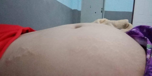 22w ท้องเล็กไปหรือป่าวค่ะ