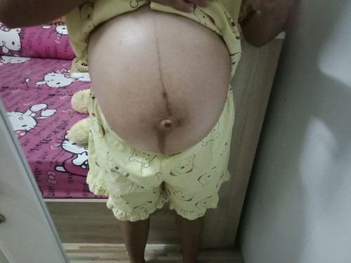 ท้องแข็งบ่อย??