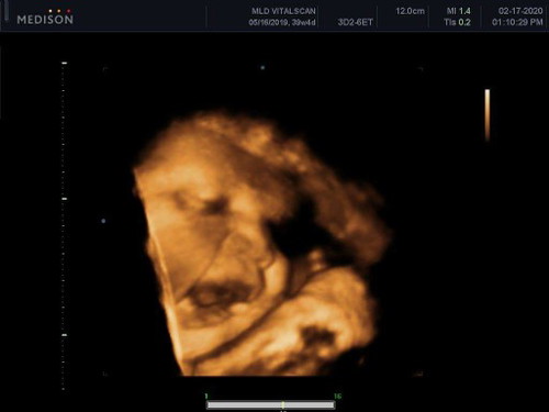 39weeks&4days